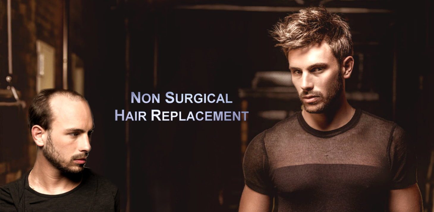 Non Surgical Procedures Hair Experts