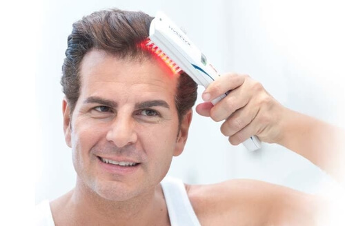LOW-LEVEL LASER THERAPY (LLLT) FOR TREATMENT OF PATTERN HAIR LOSS – Hair  Experts